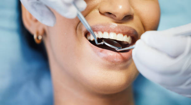Best Emergency Dentist for Knocked-Out Tooth in Orion, IL