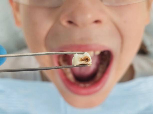 Best Orthodontic Emergency Dentist in Orion, IL